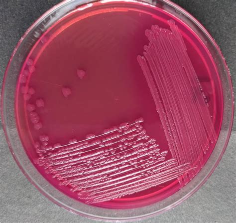 MacConkey Agar .